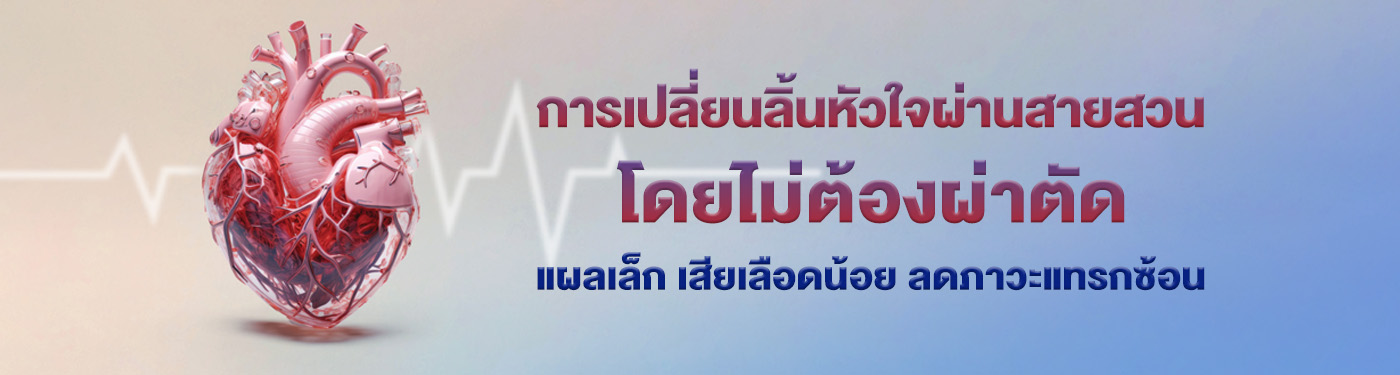 การเปลี่ยนลิ้นหัวใจผ่านสายสวน โดยไม่ต้องผ่าตัด