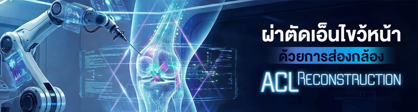 เอ็นไขว้หน้า