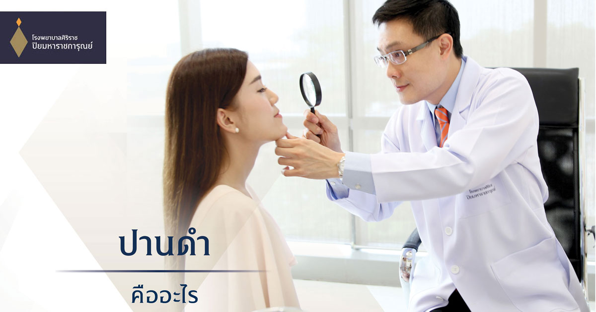 ปานดำ หากมีขนาดใหญ่ ปล่อยทิ้งไว้ เสี่ยงมะเร็งผิวหนัง (Birthmark)