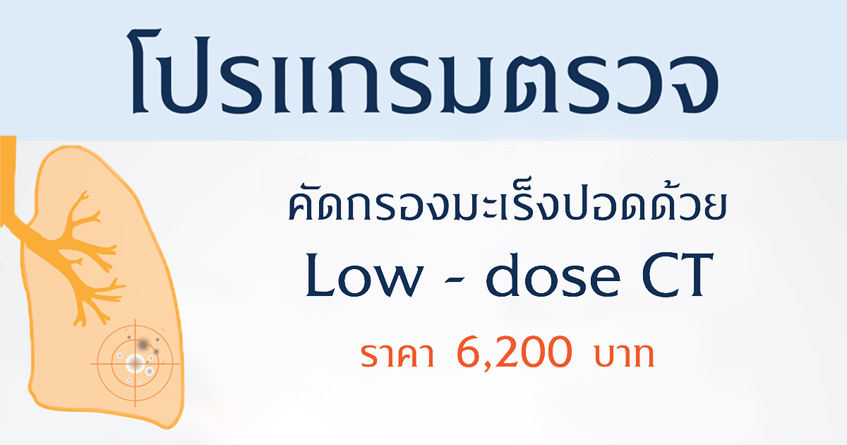 ตรวจมะเร็งปอด รู้เร็ว รักษาได้ (Low-dose CT Scan)