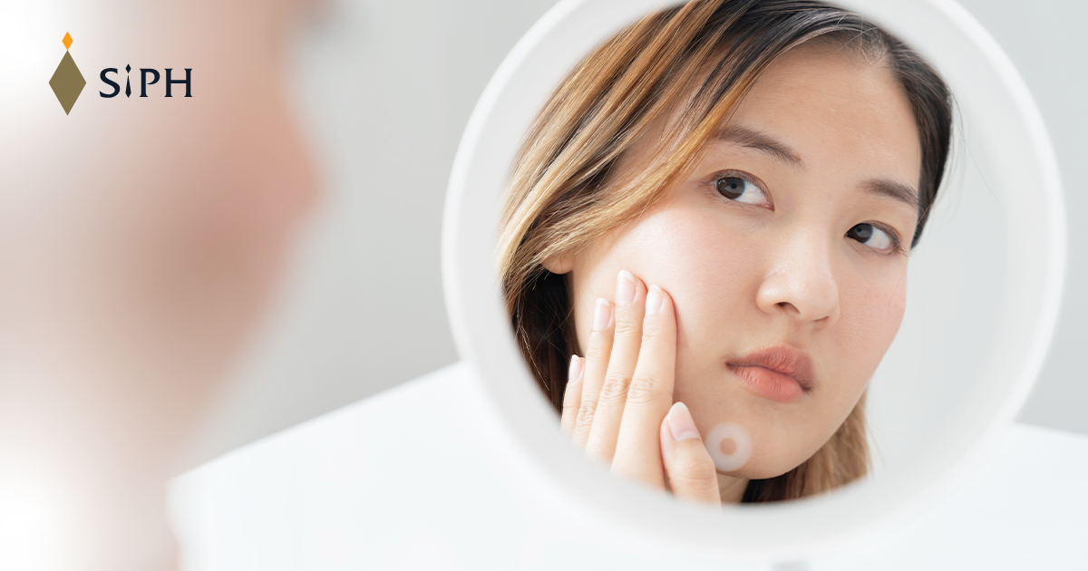 สิว (Acne) คืออะไร? รู้จักชนิด สาเหตุ และวิธีรักษาสิวให้ได้ผล
